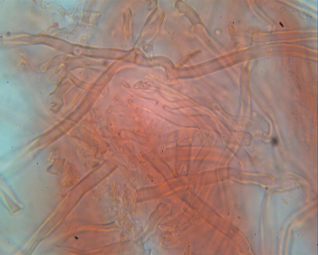 Lignicolo da determinare (Bjerkandera fumosa)